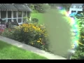 Migraine Visual Aura
