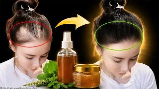 Spray it on your hair for 14 days to accelerate hair growth and prevent hair loss! 🌿✨