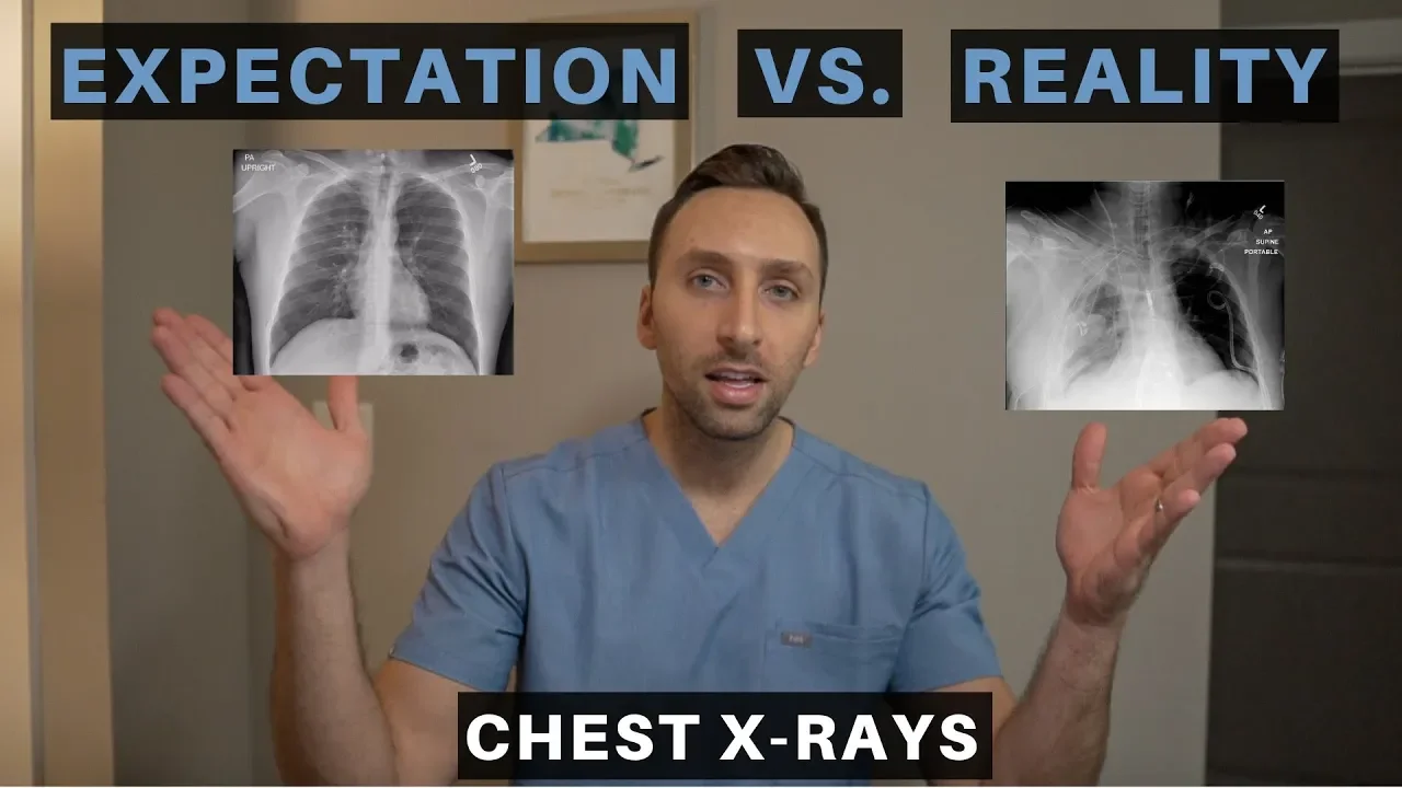 EXPECTATION vs REALITY in RADIOLOGY - How to read a Complicated Chest X-Ray