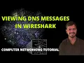 DNS Wireshark Analysis DIG command Computer Networking Tutorial Interview Question
