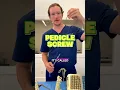 Rods and Screws