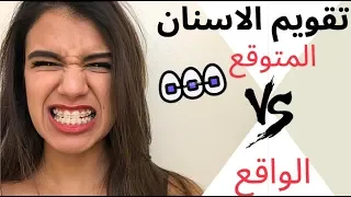 تقويم الاسنان المتوقع ضد الواقع  تقويم الاسنان المتوقع ضد الواقع