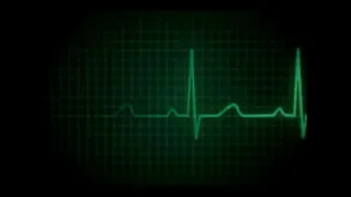 أي ولله صدك راح زين ومارد راح الغالي ابو طيب 