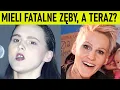 Download Lagu Znani, którzy kupili sobie uśmiech. Szokujące metamorfozy!