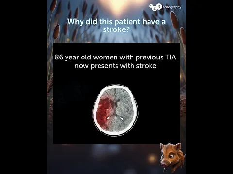 So, what did the TEE reveal? 👀