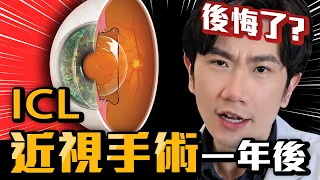 EVO ICL植入式隱形眼鏡一年了 後悔沒選近視雷射...?