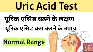 Download Uric Acid Test in Hindi | uric acid treatment |  uric acid symptoms MP3