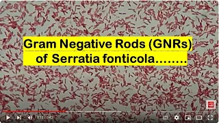 Gram Negative Rods GNRs of Serratia fonticola