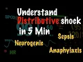 Distributive Shock The Most Confusing Type of Shock Explained