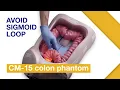 Basic Techniques of Colonoscope Insertion Ex 2 Passing sigmoid colon with abdominal compression