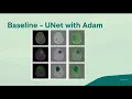 Brain Tumor Segmentation of MRI Images using Deep Learning Techniques