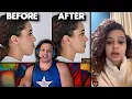 Tyler1 Macaiyla After Jaw Surgery