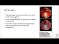 V03-01 Automated Kidney Stone Segmentation During Ureteroscopy Using Computer Vision Techniques