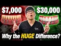 7 000 vs 30 000 All-on-4 What Makes the Price So Different