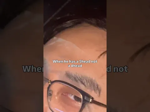 When he has a 5head not a 4head