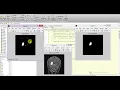 Brain Tumor Detection Using Image Processing Matlab Project