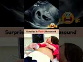 Download Lagu Biggest but Best Surprise 🥰 Twins on First Pregnancy Ultrasound Scan #pregnancy #twin
