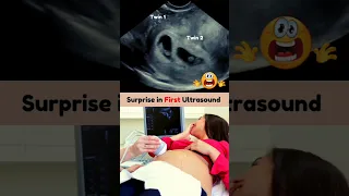 Biggest but Best Surprise Twins on First Pregnancy Ultrasound Scan
