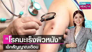  มะเร็งผิวหนังชนิดไหนที่มักเริ่มจากตุ่มเนื้อสีชมพูหรือแดง และมีลักษณะเป็นขุยหรือสะเก็ดที่ด้านบน 