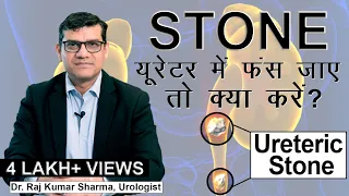 ureter kidney stone in ureter symptoms and treatment dr raj kumar sharma