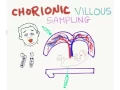 Chorionic Villus Sampling CVS Mnemonic