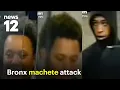 Bronx mother calls for justice after son injured in machete attack robbery