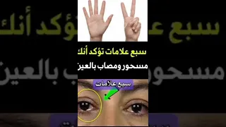 سبع علامات تدل على انك مصاب بالعين والحسد والسحر اياك ان تتجاهلها حذرنا منها النبي ﷺ 