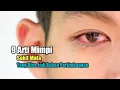 Download Lagu 9 Arti Mimpi Sakit Mata yang Bisa Jadi Bahan Pertimbangan