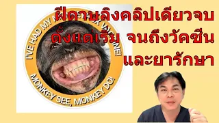 ฝีดาษลิงติดต่อกันอย่างไรบ้าง