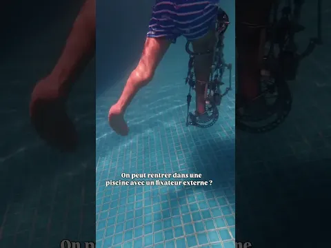 Terapía en el agua con Fijador Externo🦿