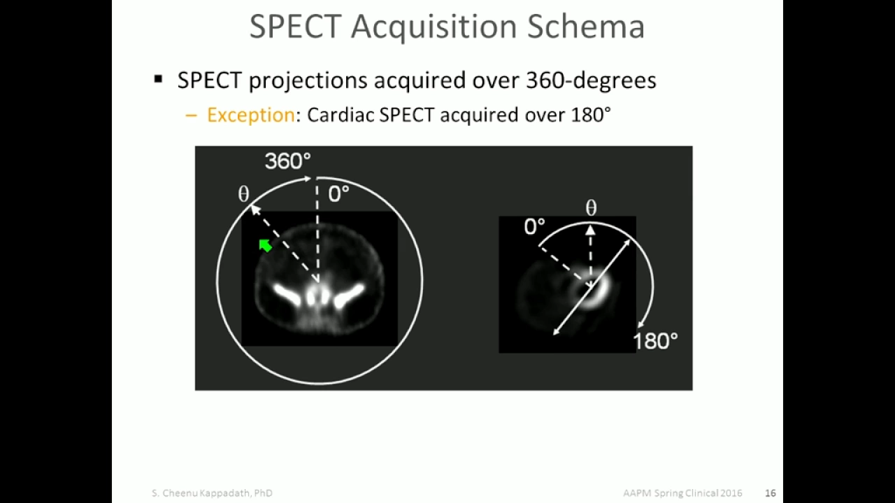 SPECT/CT Basic information , QA and applications