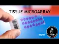 Tissue microarray - TMA