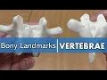 Bony Landmarks of the Vertebrae