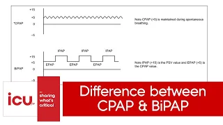 Difference between CPAP and BiPAP NIV vs CPAP