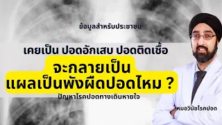 การอักเสบของปอดมีกี่ระยะ และแต่ละระยะเป็นอย่างไร