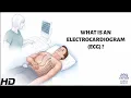 What Is An Electrocardiogram