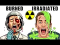 The Worst Nuclear Deaths Ever