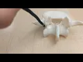 Quiz Bony Landmarks of the Vertebrae