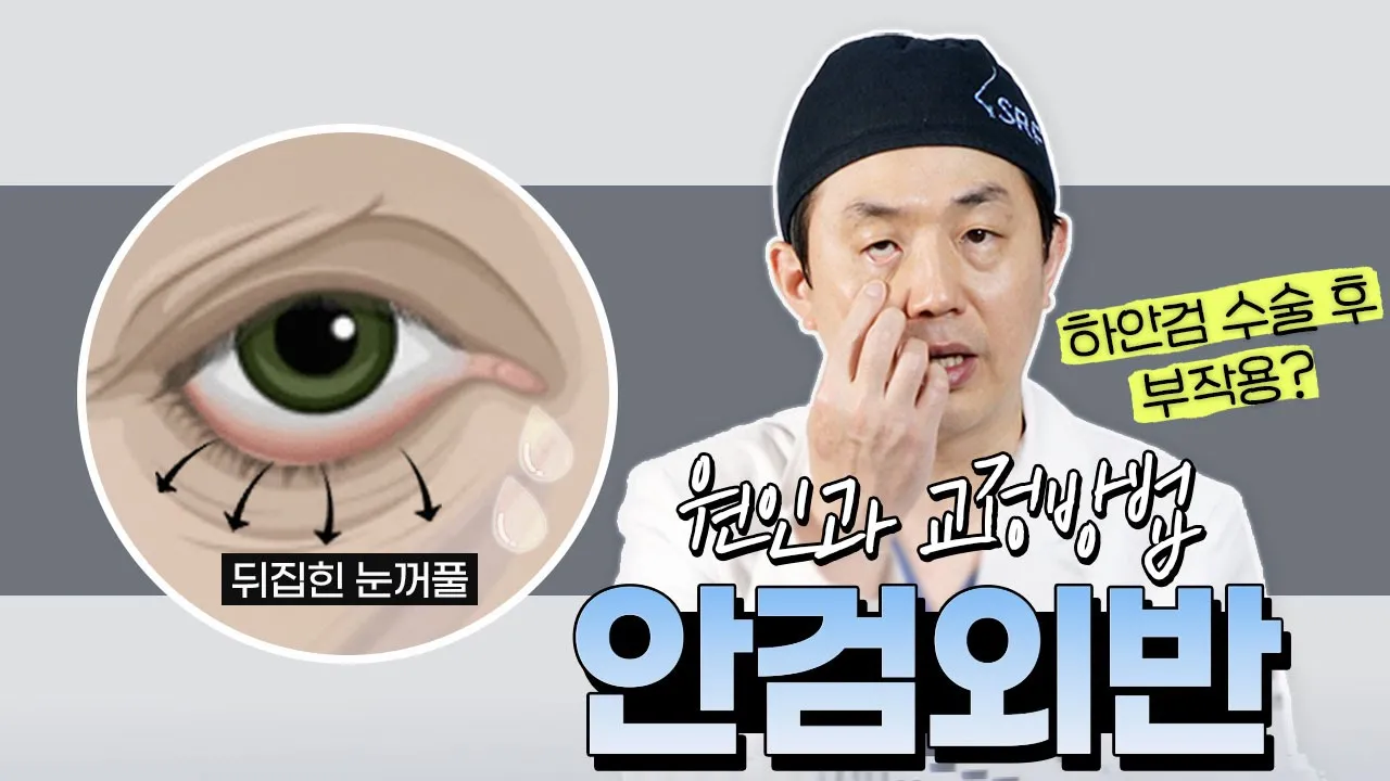하안검 수술 후 생긴 안검외반! 💢😨어떻게 교정할까?