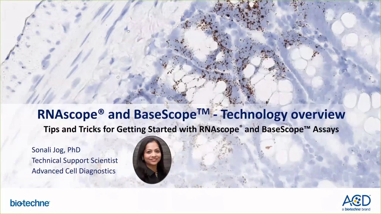 2018 Dec 18 ACD Support Webinar