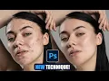 How to Remove Acne - Photoshop Tutorial For Beginners 2024