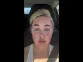 Amanda Bynes reveals new cosmetic procedure