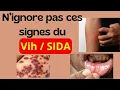 Download Lagu Quels sont les 13  signes du VIH / SIDA ?