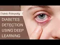 AE076 Diabetes Detection Using Deep Learning