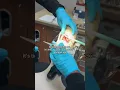 DA Oral Surgery - Phase 2