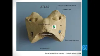 Osteologia Da Coluna Vertebral | Parte 01 | Atlas, Áxis e Vértebras Cervicais