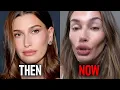 30 Celebrity Facelifts Gone Wrong Before After 2026