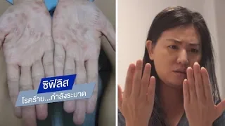 โรคซิฟิลิสคืออะไร และเกิดจากเชื้อชนิดใด