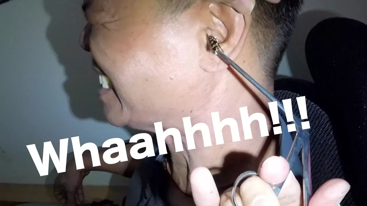 Why Q-Tips are bad. 