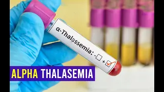 Download Alpha thalassemia - Clear Explain MP3